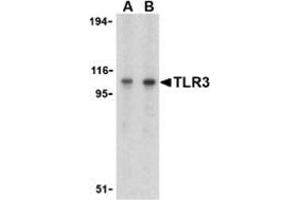 Western blot analysis of TLR3 in Daudi cell lysate with CD283 / TLR3 antibody at (A) 1 and (B) 2 μg/ml.