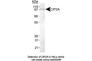 Image no. 1 for anti-KIAA1524 (KIAA1524) (C-Term) antibody (ABIN363243)