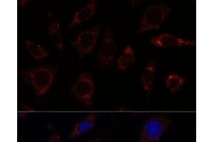 Immunofluorescence analysis of L929 cells using TBRG4 Polyclonal Antibody at dilution of 1:100. (TBRG4 Antikörper)