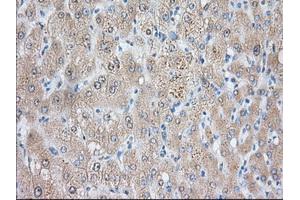 Immunohistochemical staining of paraffin-embedded Human liver tissue using anti-NIT2 mouse monoclonal antibody. (NIT2 Antikörper)