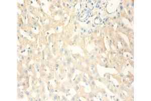 Immunohistochemistry of paraffin-embedded human liver tissue using ABIN7159537 at dilution of 1:100 (MT1X Antikörper  (AA 1-59))