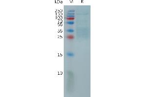 Interleukin 9 (IL9) (AA 19-144) protein (His tag)