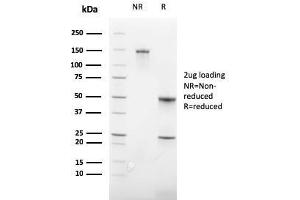 SDS-PAGE Analysis Purified CD235a Recombinant Rabbit Monoclonal Antibody (GYPA/3219R). (Rekombinanter CD235a/GYPA Antikörper)