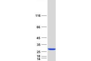 Validation with Western Blot (ARL11 Protein (Myc-DYKDDDDK Tag))