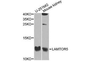 Western blot analysis of extracts of various cell lines, using LAMTOR5 antibody. (HBXIP Antikörper  (AA 1-173))