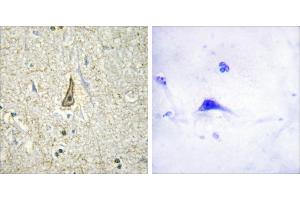 Peptide - +Immunohistochemistry analysis of paraffin-embedded human brain tissue using Cytochrome P450 26C1 antibody.