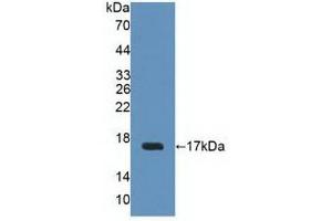 Western blot analysis of recombinant Human UPK2. (Uroplakin 2 Antikörper  (AA 26-153))
