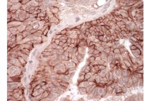 Immunohistochemistry (IHC) image for anti-Nuclear Receptor Subfamily 1, Group I, Member 3 (NR1I3) (AA 335-365) antibody (ABIN7454875)