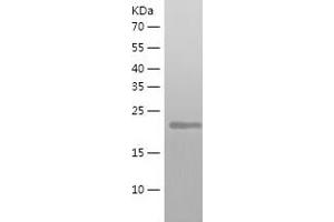 Western Blotting (WB) image for Autophagy Related 10 (ATG10) (AA 1-220) protein (His tag) (ABIN7121949) (ATG10 Protein (AA 1-220) (His tag))