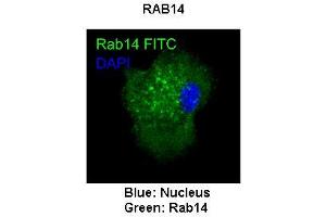 Immunohistochemistry (IHC) image for anti-RAB14, Member RAS Oncogene Family (RAB14) (C-Term) antibody (ABIN2792300)
