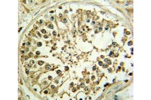 Immunohistochemistry (IHC) image for anti-Wingless-Type MMTV Integration Site Family, Member 1 (WNT1) (AA 260-288) antibody (ABIN3029624)