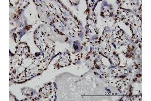 Image no. 4 for anti-TATA Box Binding Protein Associated Factor 11 (TAF11) (AA 158-211) antibody (ABIN598957) (TAF11 Antikörper  (AA 158-211))
