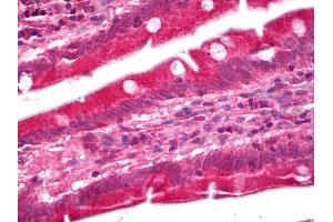 Anti-GUCY1A3 / Guanylyl Cyclase Alpha 1 antibody IHC of human small intestine. (GUCY1A1 Antikörper)