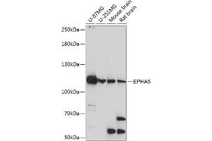 Western blot analysis of extracts of various cell lines, using EPH antibody (ABIN7266971) at 1:1000 dilution. (EPH Receptor A5 Antikörper  (AA 1-130))