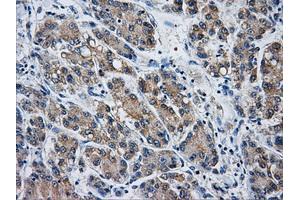 Immunohistochemistry (IHC) image for anti-Aldo-Keto Reductase Family 1, Member A1 (Aldehyde Reductase) (AKR1A1) antibody (ABIN1496541) (AKR1A1 Antikörper)