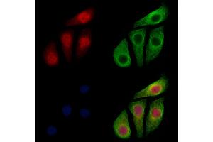 ABIN6256173 and ABIN6267231 staining Hela cells(4h of LPS treatment) by IF/ICC. (IKK-alpha /IKK-beta Antikörper  (pSer176, pSer177))