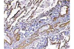 Immunohistochemistry (IHC) image for anti-Fms-Related Tyrosine Kinase 4 (FLT4) (AA 25-259) antibody (ABIN5693136)