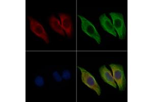 ABIN6265399 and ABIN6267024 staining Hela cells by IF/ICC.
