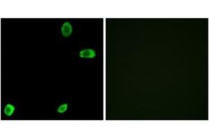 Immunofluorescence analysis of A549 cells, using TAS2R39 Antibody.
