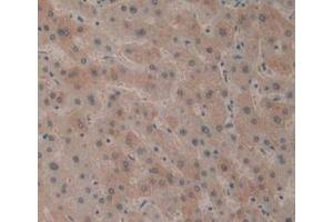 Detection of CD161 in Human Liver Tissue using Polyclonal Antibody to Cluster Of Differentiation 161 (CD161) (CD161 Antikörper  (AA 73-188))