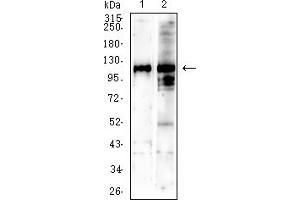Western blot analysis using SALL4 mouse mAb against NIH/3T3 (1) C2C12 (2) cell lysate. (SALL4 Antikörper  (AA 96-359))