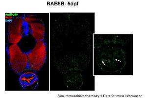Sample type: zebra gut epithelial cellsGreen: primaryRed: actinBlue: DAPIPrimary dilution: 1:5000Secondary Dilution: 1:300Image Submitted by: Michel BagnatDuke University Medical Center . (RAB5B Antikörper  (N-Term))