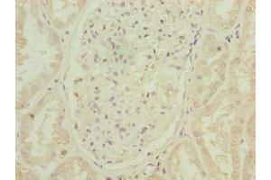 Immunohistochemistry of paraffin-embedded human kidney tissue using ABIN7144631 at dilution of 1:100 (ARPIN Antikörper  (AA 1-226))