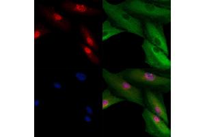 ABIN6260755 and ABIN6278972 staining  cells by IF/ICC.