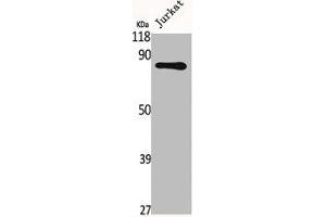 Western Blot analysis of Jurkat cells using Fyb Polyclonal Antibody (FYB1 Antikörper  (C-Term))