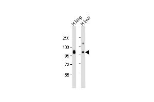 All lanes : Anti-AOC3 Antibody (Center) at 1:2000 dilution Lane 1: human lung lysate Lane 2: human liver lysate Lysates/proteins at 20 μg per lane. (AOC3 Antikörper  (AA 613-640))