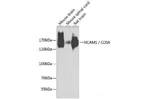 Western blot analysis of extracts of various cell lines using NCAM1 / CD56 Polyclonal Antibody at dilution of 1:1000. (CD56 Antikörper)