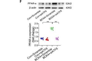 BCAA increase PPAR-α expression in a GCN2/ATF6 pathway-dependent manner. (beta Actin Antikörper)