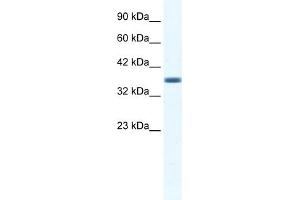 WB Suggested Anti-ANXA3 Antibody Titration:  1. (Annexin A3 Antikörper  (C-Term))