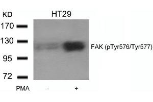 Western blot analysis of extracts from HT29 cells untreated or treated with PMA using FAK(phospho-Tyr576/Tyr577) Antibody. (FAK Antikörper  (pTyr576, pTyr577))