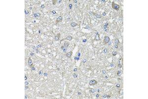 Immunohistochemistry of paraffin-embedded rat brain using GFPT1 antibody at dilution of 1:100 (x40 lens).
