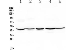 Western blot analysis of HMBS using anti-HMBS antibody . (HMBS Antikörper  (AA 6-361))