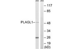 Western blot analysis of extracts from 293 cells, using PLAGL1 Antibody.