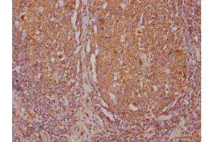 IHC image of ABIN7167502 diluted at 1:500 and staining in paraffin-embedded human lymph node tissue performed on a Leica BondTM system.