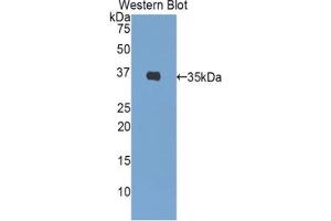 Western blot analysis of the recombinant protein. (Insulin Antikörper  (AA 88-108))