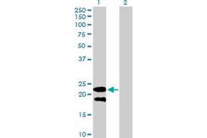 Western Blot analysis of LY6G5B expression in transfected 293T cell line by LY6G5B MaxPab polyclonal antibody. (LY6G5B Antikörper  (AA 1-201))