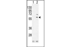 Western blot analysis of RPS6KL1 (arrow) using RPS6KL1 Antibody . (RPS6KL1 Antikörper)