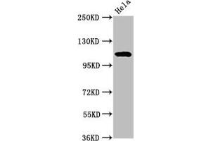 Western Blot Positive WB detected in: Hela whole cell lysate All lanes:NAT10 antibody at 7 μg/mL Secondary Goat polyclonal to rabbit IgG at 1/50000 dilution Predicted band size: 116, 108 kDa Observed band size: 116 kDa