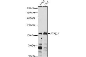 Western blot analysis of extracts of various cell lines, using A antibody (ABIN7265768) at 1:1000 dilution. (ATP12A Antikörper  (AA 890-980))