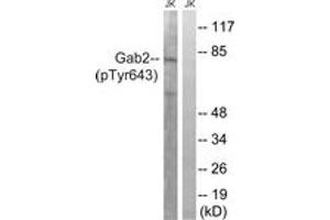 Western blot analysis of extracts from Jurkat cells treated with IFN 2500U/ML 30', using Gab2 (Phospho-Tyr643) Antibody. (GAB2 Antikörper  (pTyr643))