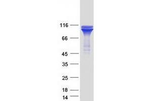Western Blotting (WB) image for Heat Shock Protein 90kDa beta (Grp94), Member 1 (HSP90B1) protein (Myc-DYKDDDDK Tag) (ABIN2720176)