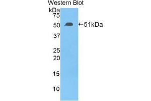 Western blot analysis of the recombinant protein. (TFAM Antikörper  (AA 43-244))
