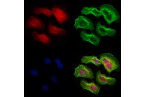 ABIN6265289 and ABIN6273076 staining Hela cells by IF/ICC. (SRP68 Antikörper  (C-Term))