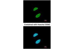 ICC/IF Image Immunofluorescence analysis of paraformaldehyde-fixed HeLa, using KAP1, antibody at 1:200 dilution.