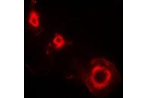 Immunofluorescent analysis of Ferritin L staining in HepG2 cells. (Ferritin L Antikörper)