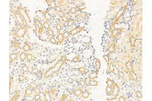 ABIN6261605 and ABIN6268755 at 1/100 staining Rat kidney tissue by IHC-P. (EpCAM Antikörper  (Internal Region))